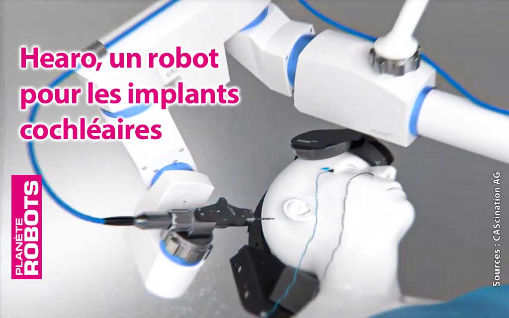 Des implants cochléaires aussi facilement que dans un jeu vidéo