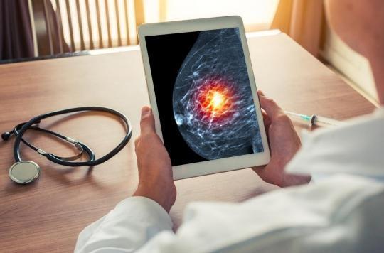 L’IA pour éviter les faux-positifs de cancer du sein